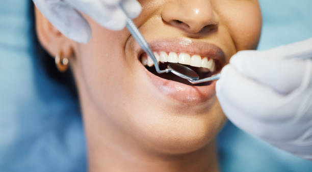 Best Dentist for Tooth Abscess  in Forest City, IA