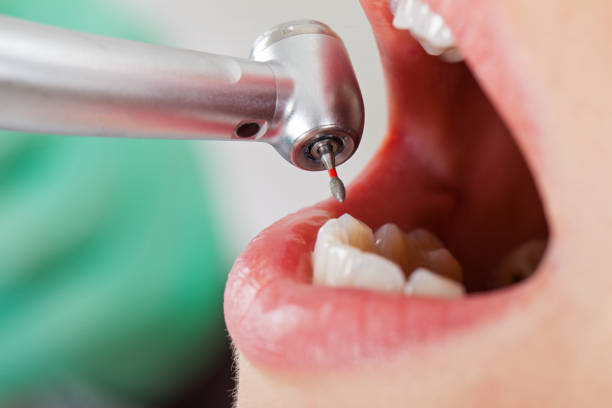 Best Emergency Gum Pain Relief  in Forest City, IA